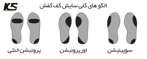 تاثیر پرونیشن پا در کفش